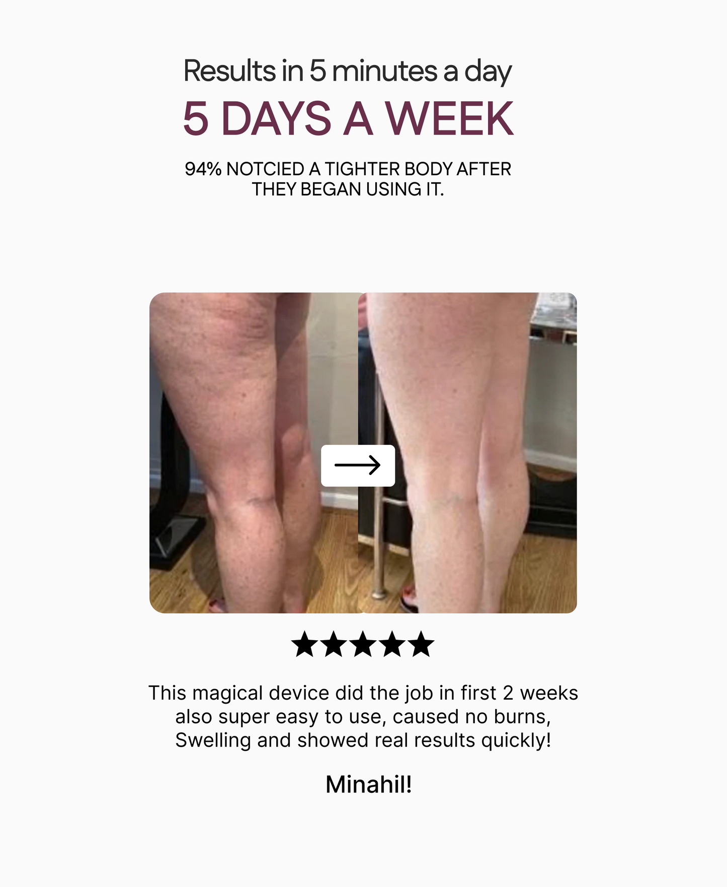 Anti Cellulite Massager